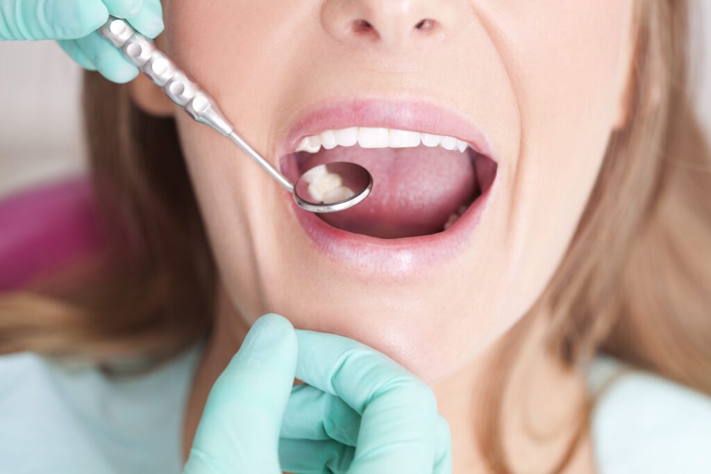 Dental Fillings in Gettysburg PA