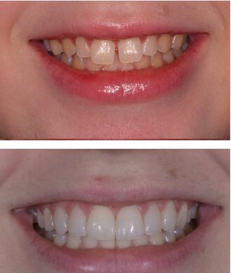 Cosmetic Dental Care in Gettysburg PA Dental Office